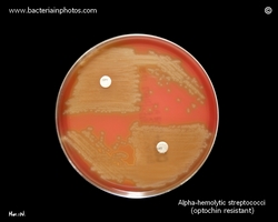 optochin resistant alpha-streptococci